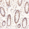 //jqrorwxhrkjnln5q-static.micyjz.com/cloud/lkBpjKnjlkSRqippojmoip/91a1a6c35ddfd2056ece1bc863c042b0-60-60.jpg