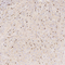 //jqrorwxhrkjnln5q-static.micyjz.com/cloud/lmBpjKnjlkSRqiqpimloiq/695e1d9a2874c601a0ca67e1ab0779d8-60-60.jpg