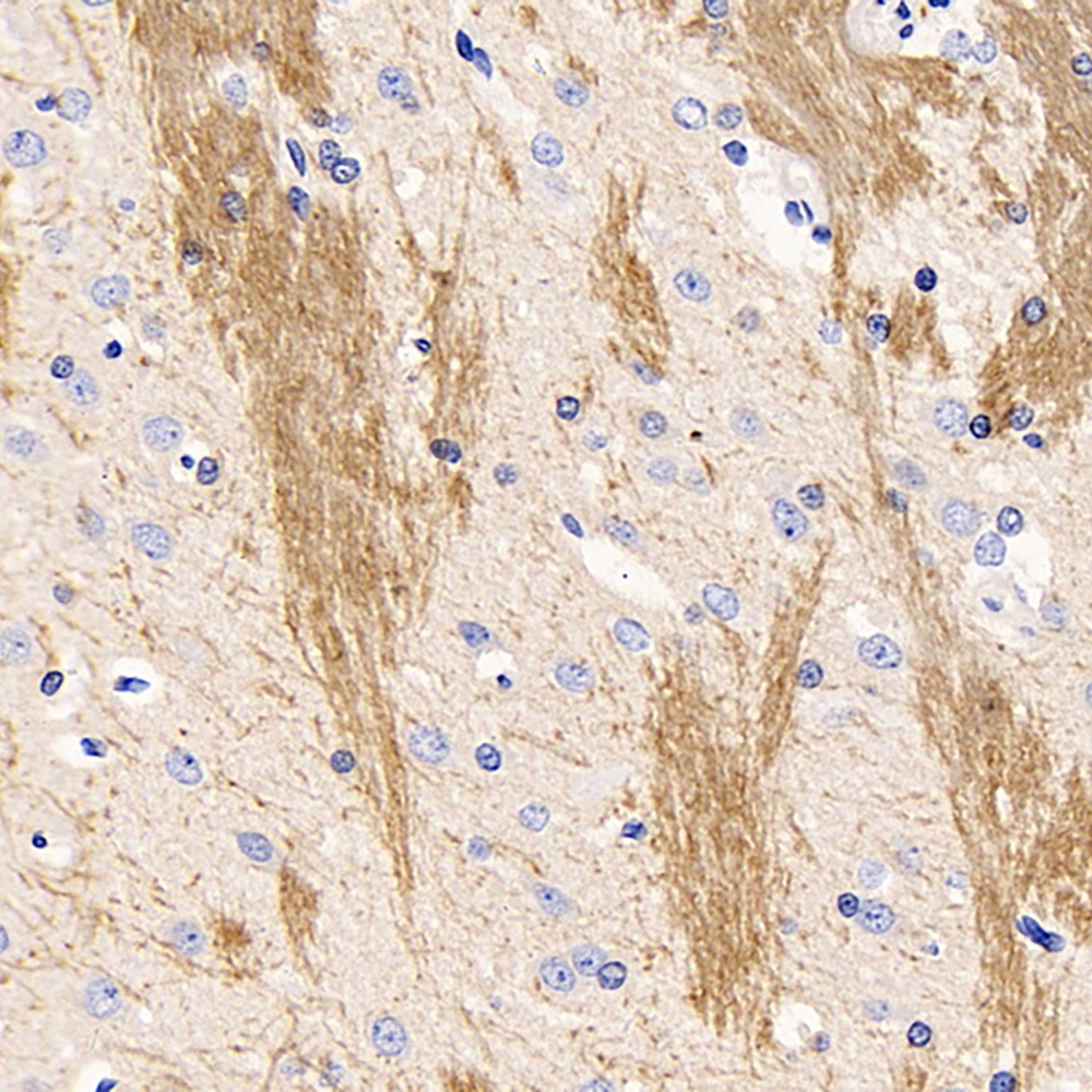 GB11226-1 Anti -Myelin Pata de lapin de la protéine de base